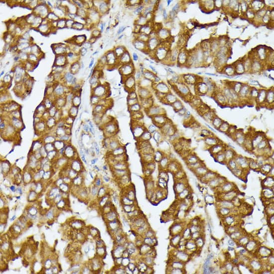 Immunohistochemistry COX15 Antibody