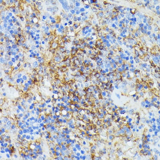 Immunohistochemistry COX15 Antibody