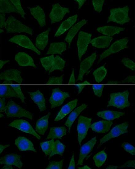 Immunocytochemistry/ Immunofluorescence: COX15 Antibody [NBP3-35454] - Immunofluorescence analysis of L929 cells using COX15 Rabbit pAb at dilution of 1:100 (40x lens). Secondary antibody: Cy3-conjugated Goat anti-Rabbit IgG (H+L) at 1:500 dilution. Blue: DAPI for nuclear staining.