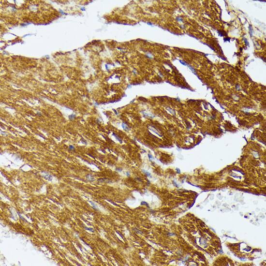 Immunohistochemistry: COX15 Antibody [NBP3-35454] - Immunohistochemistry analysis of paraffin-embedded Mouse heart using COX15 Rabbit pAb at dilution of 1:100 (40x lens). Microwave antigen retrieval performed with 0.01M PBS Buffer (pH 7.2) prior to IHC staining.