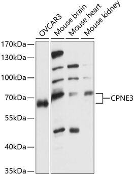 Western Blot: CPNE3 Antibody [NBP3-35456] - Western blot analysis of various lysates using CPNE3 Rabbit pAb at 1:1000 dilution.Secondary antibody: HRP-conjugated Goat anti-Rabbit IgG (H+L) at 1:10000 dilution.Lysates/proteins: 25ug per lane.Blocking buffer: 3% nonfat dry milk in TBST.Detection: ECL Basic Kit.Exposure time: 60s.