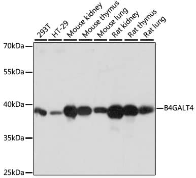 Western Blot: B4GALT4 Antibody [NBP3-35457] - Western blot analysis of various lysates using B4GALT4 Rabbit pAb at 1:1000 dilution.Secondary antibody: HRP-conjugated Goat anti-Rabbit IgG (H+L) at 1:10000 dilution.Lysates/proteins: 25ug per lane.Blocking buffer: 3% nonfat dry milk in TBST.Detection: ECL Basic Kit.Exposure time: 1s.
