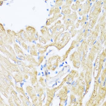 Immunohistochemistry: 12-Lipoxygenase Antibody [NBP3-35458] - Immunohistochemistry analysis of paraffin-embedded Rat heart using 12-Lipoxygenase Rabbit pAb at dilution of 1:100 (40x lens). Microwave antigen retrieval performed with 0.01M PBS Buffer (pH 7.2) prior to IHC staining.