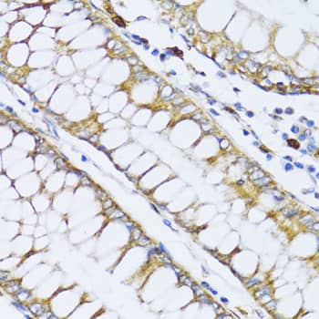 Immunohistochemistry 12-Lipoxygenase Antibody