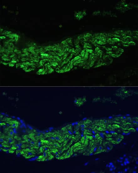 Immunocytochemistry/ Immunofluorescence 12-Lipoxygenase Antibody