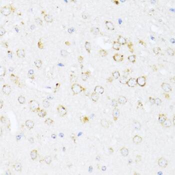 Immunohistochemistry 12-Lipoxygenase Antibody