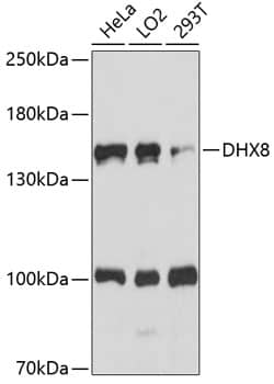 Western Blot: DHX8 Antibody [NBP3-35462] - Western blot analysis of various lysates using DHX8 Rabbit pAb at 1:1000 dilution.Secondary antibody: HRP-conjugated Goat anti-Rabbit IgG (H+L) at 1:10000 dilution.Lysates/proteins: 25ug per lane.Blocking buffer: 3% nonfat dry milk in TBST.Detection: ECL Basic Kit.Exposure time: 90s.