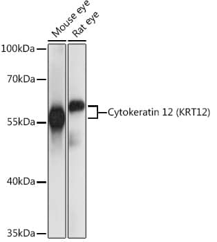 Western Blot: Cytokeratin 12 Antibody [NBP3-35465] - Western blot analysis of various lysates using Cytokeratin 12(KRT12) Rabbit pAb at 1:1000 dilution.Secondary antibody: HRP-conjugated Goat anti-Rabbit IgG (H+L) at 1:10000 dilution.Lysates/proteins: 25ug per lane.Blocking buffer: 3% nonfat dry milk in TBST.Detection: ECL Basic Kit.Exposure time: 1s.