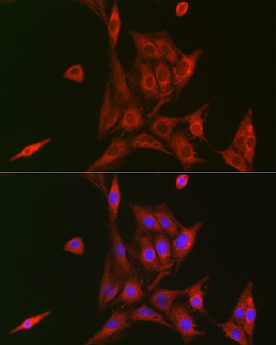 Immunocytochemistry/ Immunofluorescence: NFkB p105/p50 Antibody [NBP3-35466] - Immunofluorescence analysis of BALB-3T3 cells using NFkB p105/p50 Rabbit pAb at dilution of 1:100 (40x lens). Secondary antibody: Cy3-conjugated Goat anti-Rabbit IgG (H+L) at 1:500 dilution. Blue: DAPI for nuclear staining.