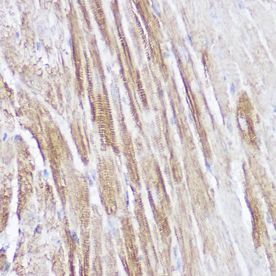 Immunohistochemistry: Atrial Natriuretic Peptide/ANP Antibody [NBP3-35467] - Immunohistochemistry analysis of paraffin-embedded Mouse heart using Atrial Natriuretic Peptide/ANP Rabbit pAb at dilution of 1:100 (40x lens). High pressure antigen retrieval performed with 0.01M Citrate Bufferr (pH 6.0) prior to IHC staining.