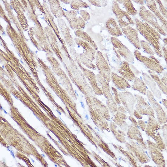 Immunohistochemistry: Atrial Natriuretic Peptide/ANP Antibody [NBP3-35467] - Immunohistochemistry analysis of paraffin-embedded Rat heart using Atrial Natriuretic Peptide/ANP Rabbit pAb at dilution of 1:100 (40x lens). High pressure antigen retrieval performed with 0.01M Citrate Bufferr (pH 6.0) prior to IHC staining.