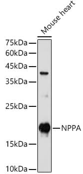 Western Blot: Atrial Natriuretic Peptide/ANP Antibody [NBP3-35467] - Western blot analysis of lysates from Mouse heart, using Atrial Natriuretic Peptide/ANP Rabbit pAb at 1:1000 dilution.Secondary antibody: HRP-conjugated Goat anti-Rabbit IgG (H+L) at 1:10000 dilution.Lysates/proteins: 25ug per lane.Blocking buffer: 3% nonfat dry milk in TBST.Detection: ECL Enhanced Kit.Exposure time: 180s.