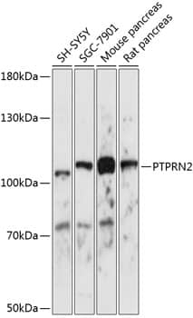 Western Blot PTPRN2 Antibody