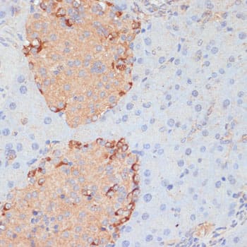 Immunohistochemistry: PTPRN2 Antibody [NBP3-35468] - Immunohistochemistry analysis of paraffin-embedded Mouse pancreas using PTPRN2 Rabbit pAb at dilution of 1:100 (40x lens). Microwave antigen retrieval performed with 0.01M PBS Buffer (pH 7.2) prior to IHC staining.