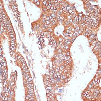 Immunohistochemistry PTPRN2 Antibody