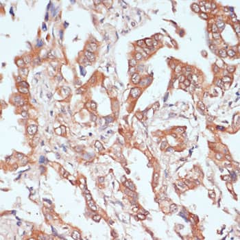 Immunohistochemistry PTPRN2 Antibody