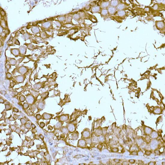 Immunohistochemistry: CAT1 Antibody [NBP3-35470] - Immunohistochemistry analysis of paraffin-embedded Rat testis using CAT1 Rabbit pAb at dilution of 1:100 (40x lens). High pressure antigen retrieval performed with 0.01M Citrate Bufferr (pH 6.0) prior to IHC staining.