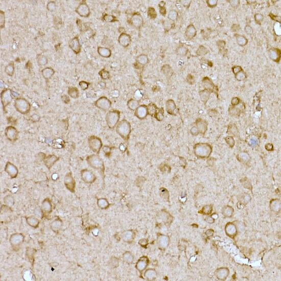 Immunohistochemistry: CAT1 Antibody [NBP3-35470] - Immunohistochemistry analysis of paraffin-embedded Mouse brain using CAT1 Rabbit pAb at dilution of 1:100 (40x lens). High pressure antigen retrieval performed with 0.01M Citrate Bufferr (pH 6.0) prior to IHC staining.