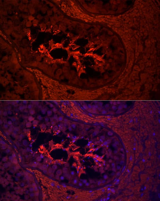 Immunocytochemistry/ Immunofluorescence: AKAP4 Antibody [NBP3-35471] - Immunofluorescence analysis of paraffin-embedded human testis using AKAP4 Rabbit pAb at dilution of 1:200 (40x lens). Secondary antibody: Cy3-conjugated Goat anti-Rabbit IgG (H+L) at 1:500 dilution. Blue: DAPI for nuclear staining.Perform high pressure antigen retrieval with 0.01 M citrate buffer (pH 6.0) prior to IF staining.