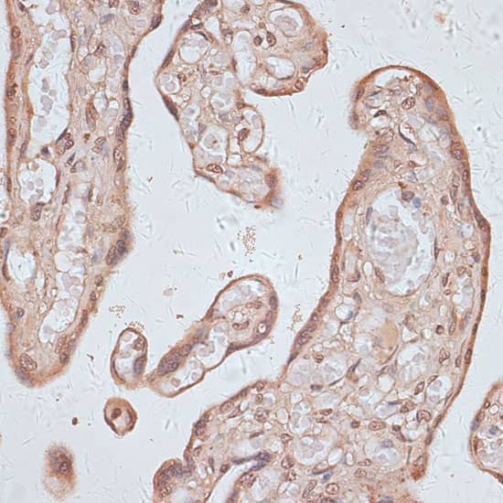 Immunohistochemistry: TLK1 Antibody [NBP3-35473] - Immunohistochemistry analysis of paraffin-embedded Human placenta using TLK1 Rabbit pAb at dilution of 1:100 (40x lens). Microwave antigen retrieval performed with 0.01M PBS Buffer (pH 7.2) prior to IHC staining.