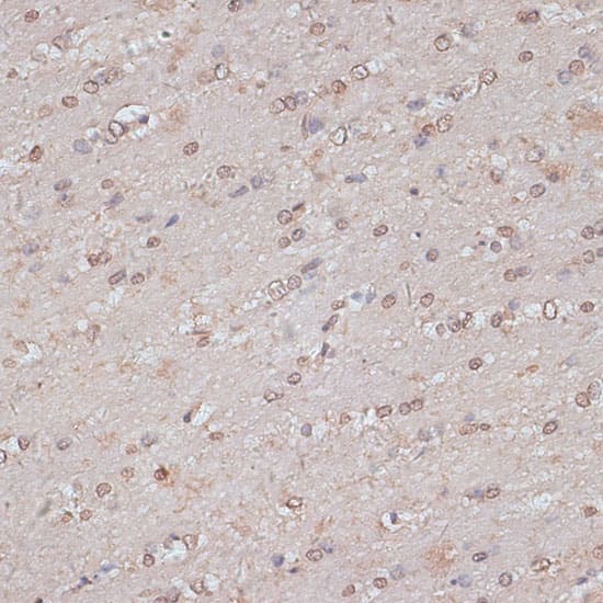 Immunohistochemistry: TLK1 Antibody [NBP3-35473] - Immunohistochemistry analysis of paraffin-embedded Mouse brain using TLK1 Rabbit pAb at dilution of 1:100 (40x lens). Microwave antigen retrieval performed with 0.01M PBS Buffer (pH 7.2) prior to IHC staining.