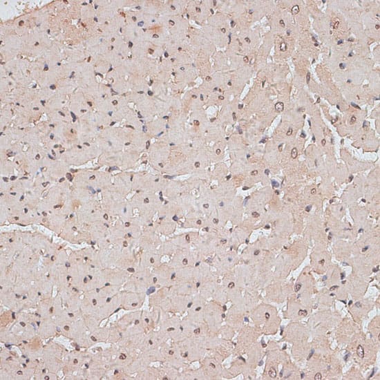 Immunohistochemistry: TLK1 Antibody [NBP3-35473] - Immunohistochemistry analysis of paraffin-embedded Rat heart using TLK1 Rabbit pAb at dilution of 1:100 (40x lens). Microwave antigen retrieval performed with 0.01M PBS Buffer (pH 7.2) prior to IHC staining.