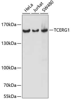 Western Blot: TCERG1 Antibody [NBP3-35474] - Western blot analysis of various lysates using TCERG1 Rabbit pAb at 1:1000 dilution.Secondary antibody: HRP-conjugated Goat anti-Rabbit IgG (H+L) at 1:10000 dilution.Lysates/proteins: 25ug per lane.Blocking buffer: 3% nonfat dry milk in TBST.Detection: ECL Basic Kit.Exposure time: 5s.