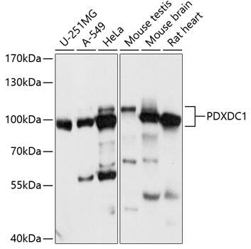 Western Blot: PDXDC1 Antibody [NBP3-35475] - Western blot analysis of various lysates using PDXDC1 Rabbit pAb at 1:1000 dilution.Secondary antibody: HRP-conjugated Goat anti-Rabbit IgG (H+L) at 1:10000 dilution.Lysates/proteins: 25ug per lane.Blocking buffer: 3% nonfat dry milk in TBST.Detection: ECL Basic Kit.Exposure time: 30s.