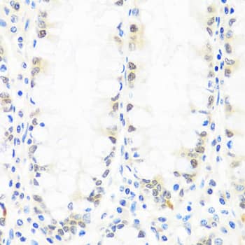 Immunohistochemistry: BRMS1 Antibody [NBP3-35476] - Immunohistochemistry analysis of paraffin-embedded Human colon using BRMS1 Rabbit pAb at dilution of 1:100 (40x lens). Microwave antigen retrieval performed with 0.01M PBS Buffer (pH 7.2) prior to IHC staining.