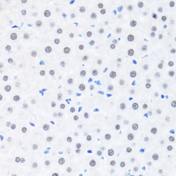 Immunohistochemistry: BRMS1 Antibody [NBP3-35476] - Immunohistochemistry analysis of paraffin-embedded Rat liver using BRMS1 Rabbit pAb at dilution of 1:100 (40x lens). Microwave antigen retrieval performed with 0.01M PBS Buffer (pH 7.2) prior to IHC staining.