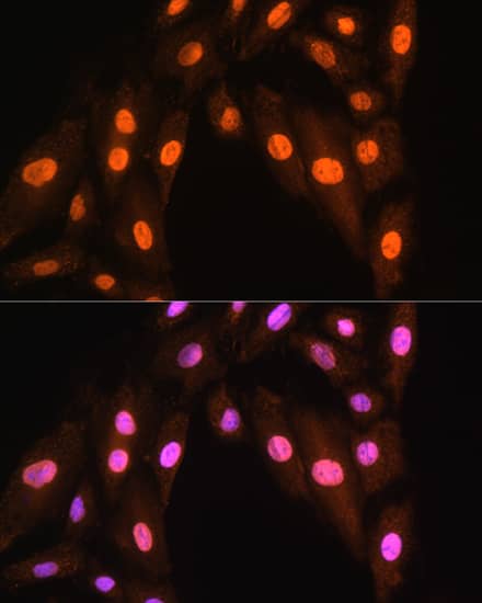 Immunocytochemistry/ Immunofluorescence: BRMS1 Antibody [NBP3-35476] - Immunofluorescence analysis of H9C2 cells using BRMS1 Rabbit pAb at dilution of 1:100. Secondary antibody: Cy3-conjugated Goat anti-Rabbit IgG (H+L) at 1:500 dilution. Blue: DAPI for nuclear staining.