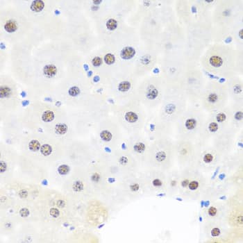 Immunohistochemistry: BRMS1 Antibody [NBP3-35476] - Immunohistochemistry analysis of paraffin-embedded Mouse liver using BRMS1 Rabbit pAb at dilution of 1:100 (40x lens). Microwave antigen retrieval performed with 0.01M PBS Buffer (pH 7.2) prior to IHC staining.