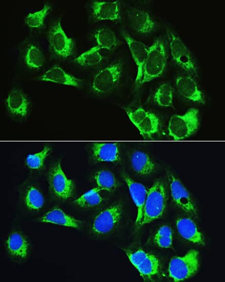 Immunocytochemistry/ Immunofluorescence: LARS Antibody [NBP3-35479] - Immunofluorescence analysis of U2OS cells using LARS Rabbit pAb at dilution of 1:100. Secondary antibody: Cy3-conjugated Goat anti-Rabbit IgG (H+L) at 1:500 dilution. Blue: DAPI for nuclear staining.