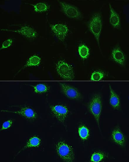 Immunocytochemistry/ Immunofluorescence: LARS Antibody [NBP3-35479] - Immunofluorescence analysis of L929 cells using LARS Rabbit pAb at dilution of 1:100. Secondary antibody: Cy3-conjugated Goat anti-Rabbit IgG (H+L) at 1:500 dilution. Blue: DAPI for nuclear staining.