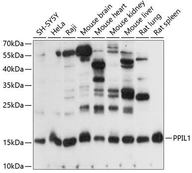 Western Blot: PPIL1 Antibody [NBP3-35480] - Western blot analysis of various lysates using PPIL1 Rabbit pAb at 1:1000 dilution.Secondary antibody: HRP-conjugated Goat anti-Rabbit IgG (H+L) at 1:10000 dilution.Lysates/proteins: 25ug per lane.Blocking buffer: 3% nonfat dry milk in TBST.Detection: ECL Basic Kit.Exposure time: 30s.