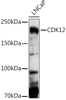 Western Blot: CrkRS Antibody [NBP3-35482] - Western blot analysis of lysates from LNCaP cells, using CrkRS Rabbit pAb at 1:1000 dilution.Secondary antibody: HRP-conjugated Goat anti-Rabbit IgG (H+L) at 1:10000 dilution.Lysates/proteins: 25ug per lane.Blocking buffer: 3% nonfat dry milk in TBST.Detection: ECL Basic Kit.Exposure time: 90s.