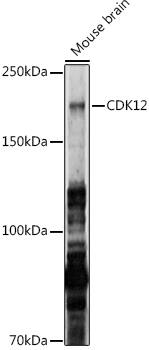 Western Blot: CrkRS Antibody [NBP3-35482] - Western blot analysis of lysates from Mouse brain, using CrkRS Rabbit pAb at 1:1000 dilution.Secondary antibody: HRP-conjugated Goat anti-Rabbit IgG (H+L) at 1:10000 dilution.Lysates/proteins: 25ug per lane.Blocking buffer: 3% nonfat dry milk in TBST.Detection: ECL Basic Kit.Exposure time: 90s.