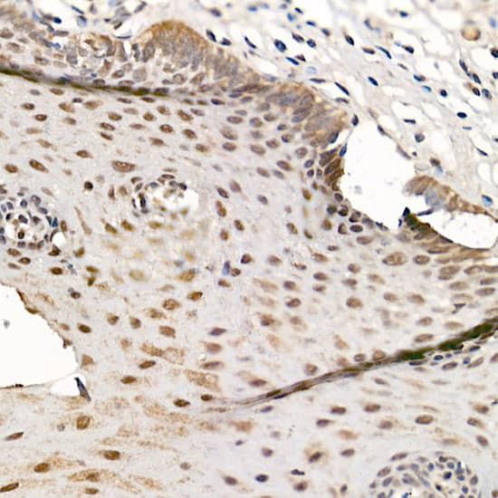 Immunohistochemistry: CrkRS Antibody [NBP3-35482] - Immunohistochemistry analysis of paraffin-embedded Human esophagus using CrkRS Rabbit pAb at dilution of 1:500 (40x lens). High pressure antigen retrieval performed with 0.01M Citrate Bufferr (pH 6.0) prior to IHC staining.