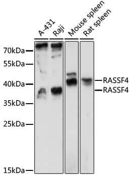 Western Blot: RASSF4 Antibody [NBP3-35486] - Western blot analysis of various lysates using RASSF4 Rabbit pAb at 1:1000 dilution.Secondary antibody: HRP-conjugated Goat anti-Rabbit IgG (H+L) at 1:10000 dilution.Lysates/proteins: 25ug per lane.Blocking buffer: 3% nonfat dry milk in TBST.Detection: ECL Basic Kit.Exposure time: 90s.