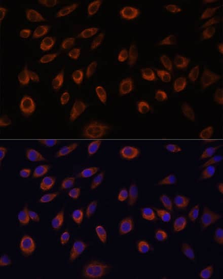 Immunocytochemistry/ Immunofluorescence NTPCR Antibody