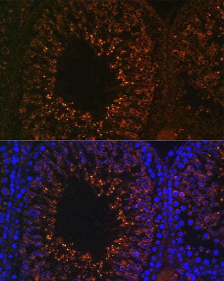 Immunocytochemistry/ Immunofluorescence LDHAL6B Antibody - BSA Free