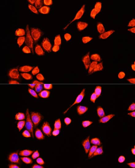 Immunocytochemistry/ Immunofluorescence: DNAJC19 Antibody [NBP3-35489] - Immunofluorescence analysis of Hela cells using DNAJC19 Rabbit pAb at dilution of 1:100 (40x lens). Secondary antibody: Cy3-conjugated Goat anti-Rabbit IgG (H+L) at 1:500 dilution. Blue: DAPI for nuclear staining.