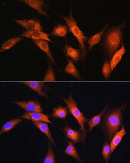 Immunocytochemistry/ Immunofluorescence: Coatomer Subunit Delta Antibody [NBP3-35490] - Immunofluorescence analysis of NIH/3T3 cells using Coatomer Subunit Delta Rabbit pAb at dilution of 1:100. Secondary antibody: Cy3-conjugated Goat anti-Rabbit IgG (H+L) at 1:500 dilution. Blue: DAPI for nuclear staining.