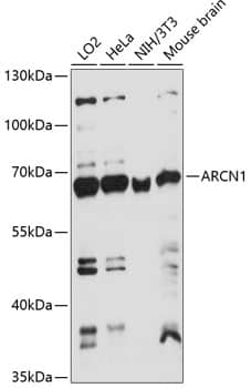 Western Blot: Coatomer Subunit Delta Antibody [NBP3-35490] - Western blot analysis of various lysates using Coatomer Subunit Delta Rabbit pAb at 1:1000 dilution.Secondary antibody: HRP-conjugated Goat anti-Rabbit IgG (H+L) at 1:10000 dilution.Lysates/proteins: 25ug per lane.Blocking buffer: 3% nonfat dry milk in TBST.Detection: ECL Basic Kit.Exposure time: 60s.