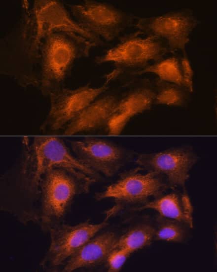 Immunocytochemistry/ Immunofluorescence: Coatomer Subunit Delta Antibody [NBP3-35490] - Immunofluorescence analysis of C6 cells using Coatomer Subunit Delta Rabbit pAb at dilution of 1:100. Secondary antibody: Cy3-conjugated Goat anti-Rabbit IgG (H+L) at 1:500 dilution. Blue: DAPI for nuclear staining.