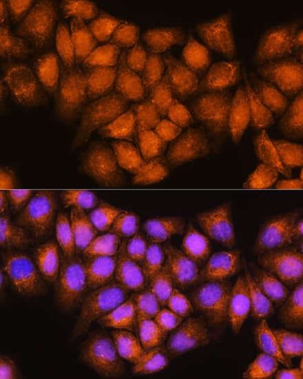 Immunocytochemistry/ Immunofluorescence: Coatomer Subunit Delta Antibody [NBP3-35490] - Immunofluorescence analysis of HeLa cells using Coatomer Subunit Delta Rabbit pAb at dilution of 1:100. Secondary antibody: Cy3-conjugated Goat anti-Rabbit IgG (H+L) at 1:500 dilution. Blue: DAPI for nuclear staining.