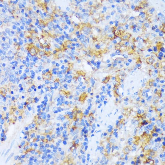 Immunohistochemistry Alanyl tRNA synthetase Antibody