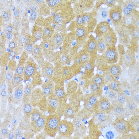 Immunohistochemistry Alanyl tRNA synthetase Antibody