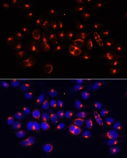 Immunocytochemistry/ Immunofluorescence Alanyl tRNA synthetase Antibody