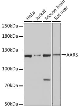 Western Blot: Alanyl tRNA synthetase Antibody [NBP3-35492] - Western blot analysis of various lysates using Alanyl tRNA synthetase Rabbit pAb at 1:3000 dilution.Secondary antibody: HRP-conjugated Goat anti-Rabbit IgG (H+L) at 1:10000 dilution.Lysates/proteins: 25ug per lane.Blocking buffer: 3% nonfat dry milk in TBST.Detection: ECL Basic Kit.Exposure time: 10s.